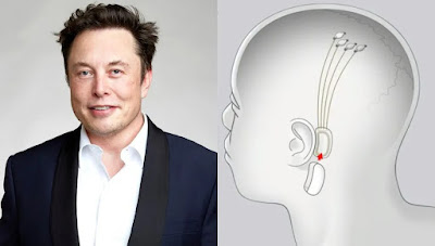 Elon musk chip