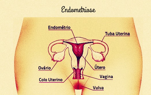 EndoMarcha no Recife