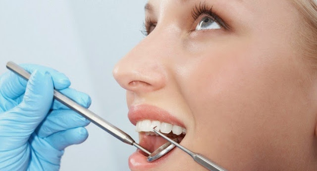 Cara Ampuh Untuk Mencegah Timbulnya Karang Gigi