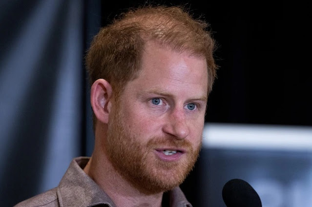Trapianto di Capelli per il Principe Harry? L'Opinione di un Esperto