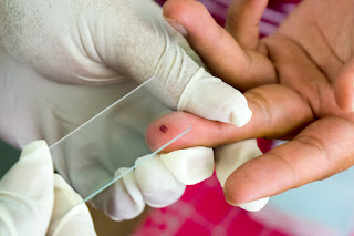 http://www.ciencia-online.net/2013/05/diagnosticar-malaria-em-15-minutos.html