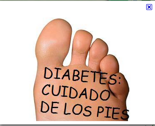 Diabetes lucha diaria: ¿Tienes diabetes??, ten cuidado con tus pies.