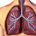 Simple Definition and Description of Lung Cancer