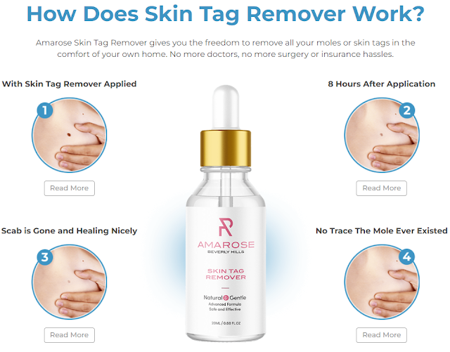 Amarose Skin Tag Remover Its Will Help To Remove Skin Tags Dark Moles Light Moles Big Warts Permanently(REAL OR HOAX)