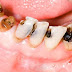 Nguyên nhân và cách chữa nhức răng cho trẻ