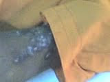 PYODERMA