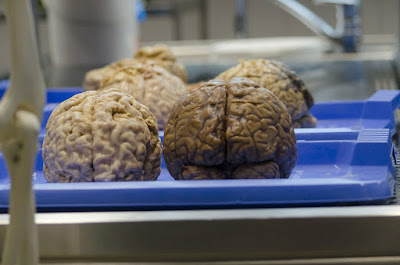 Does Bacteria Live in Brain?