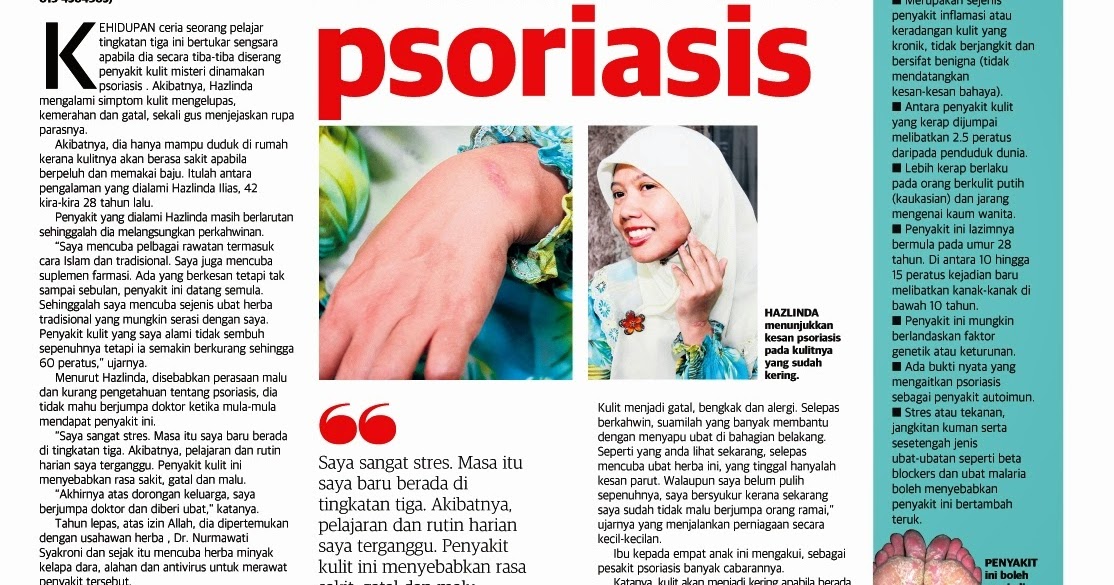 27 Tahun Derita Psoriasis ~ RUMAH SIHAT AN-NABAAT