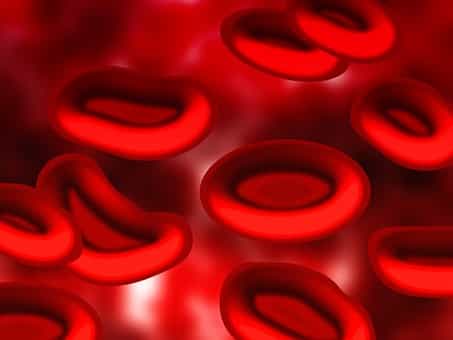 anemia ayurvedic cure