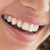 10 Kebiasaan Buruk Yang Bisa merusak Gigi Kita