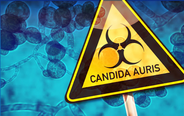 Ο μυστηριώδης πολυανθεκτικός μύκητας Candida Auris. Τι είναι και πώς εξαπλώνεται; Τι γίνεται στη χώρα μας; 