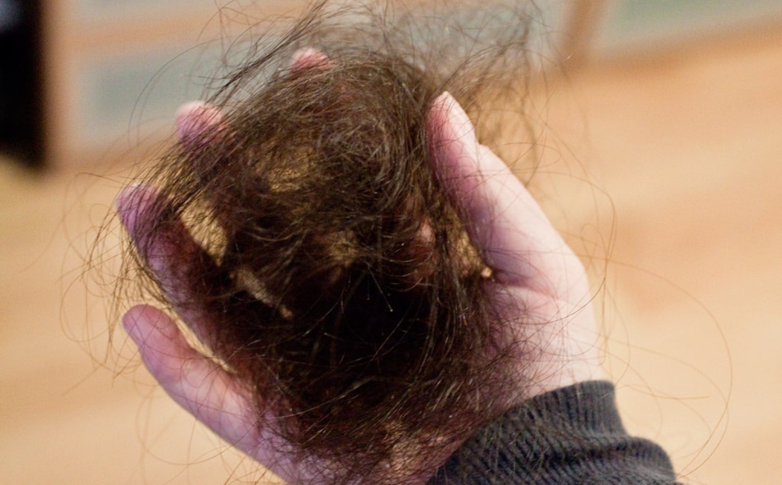 Cara Mengatasi Dan Mencegah Rambut Rontok Tips Cara Merawat Rambut