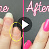 How To Fix A Broken Nail At Home Within 2 Minutes