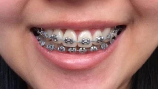 orthodontist Dubai