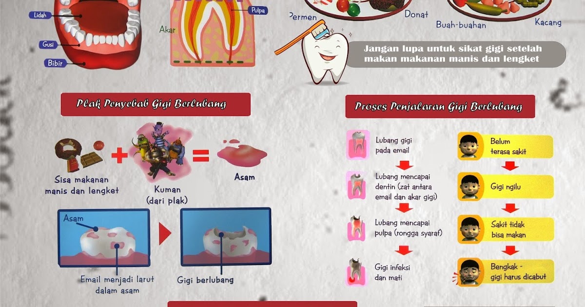  Poster  Penyuluhan Kesehatan  Gigi  dan Mulut Dent ias notes