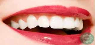 كيفية العناية بالفم والأسنان