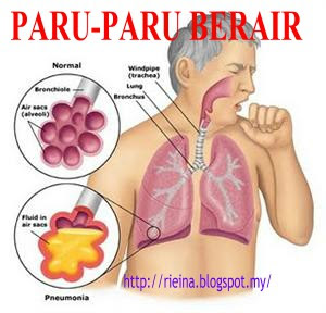 Paru-Paru BerAir