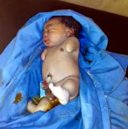 baby born without arms ogun state