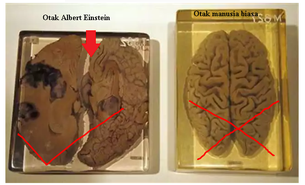 ALL ABOUT OTAK EINSTEIN VS OTAK MANUSIA BIASA