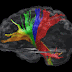 Muestran "mapa" con las conexiones del cerebro humano