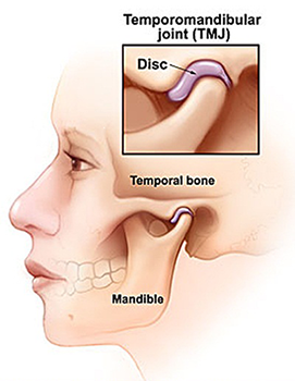 ayurvedic treatment for TMJ, temporomandibular joint disease