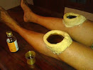 Ayurvedic treatment method