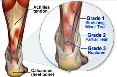 Orthopedic in Mumbai