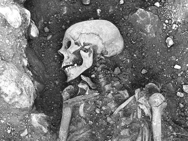 Restos de um portador de varíola enterrado em Öland, Suécia, entre 800 e 1050 d.C. Crédito: The Swedish National Heritage Board