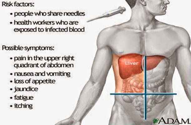 hepatitis_liver_pic