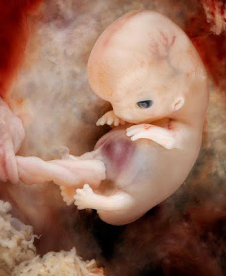 The Fetus In Motion