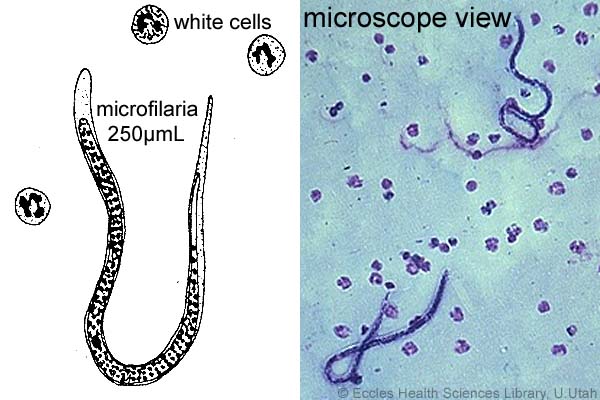 SatuHati8 8SatuCinta Wuchereria bancrofti Cacing Filaria  