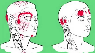 Липсата на тези храни причинява главоболие, косопад  изтръпване на крайниците