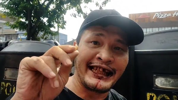 Mulutnya Berdarah Dipukul Polisi Saat Demo, Nicho Silalahi: Saya Jadi Korban Penyiksaan!