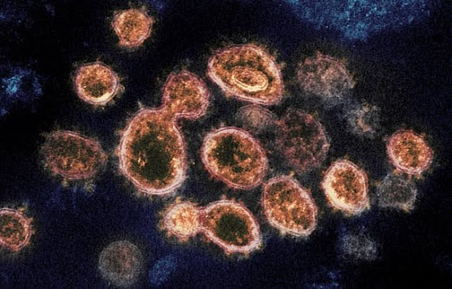 Covid-19 began spreading in January that was mistaken for flu
