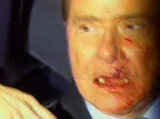 Berlusconi attacked