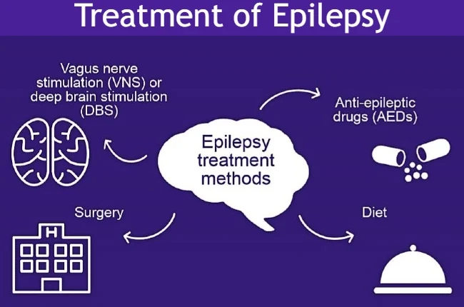 treatment of epilepsy