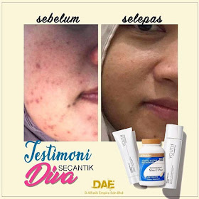 Produk Skincare Untuk Mengecilkan Liang Pori Kulit Muka Besar