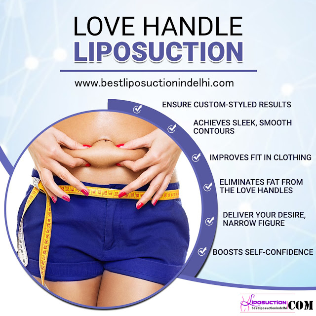 liposuction