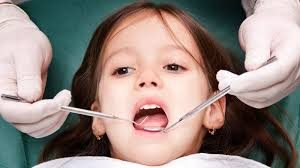 Điều trị răng mọc lệch cho bé nên biết