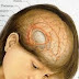 Obat Tumor Jinak Di Kepala Berkhasiat 