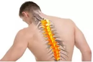 Spinal disease