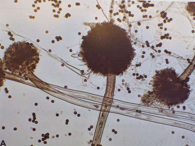 Aspergillus niger