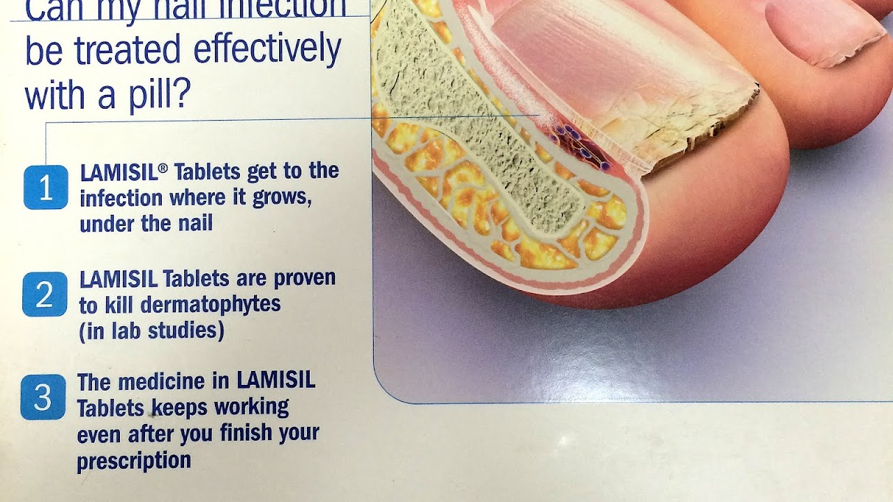 Terbinafine - Side Effects Lamisil