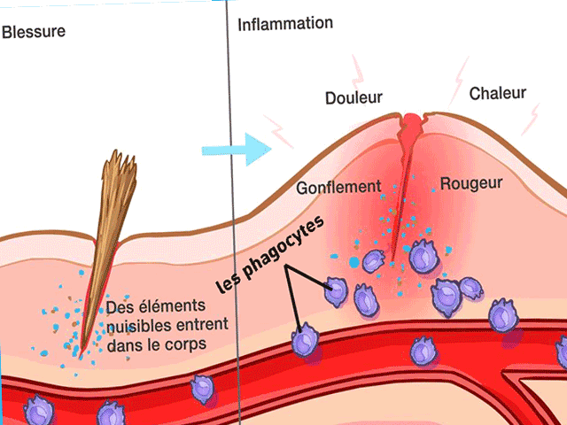 les mécanismes de la réponse immunitaire inflammatoire