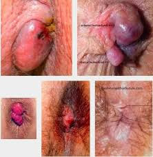 Obat Denature Ambejos