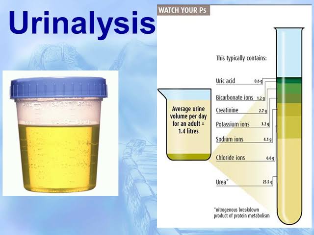 CHARACTERISTICS OF URINE bmlt dmlt