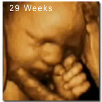 3d Ultrasound 29 Weeks3