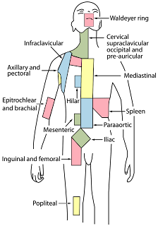   cancer de la lymphe, cancer de la lymphe chance de survie, cancer ganglions lymphatiques chance de survie, cancer lymphatique guerison, cancer de la lymphe stade 4, cancer des ganglions chance de survie, lymphome prise de sang, lymphome stade 4, systeme lymphatique des jambes