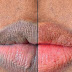 5 Home Remedies you can use for pink and Soft lips