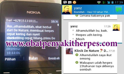 obat herpes bernanah